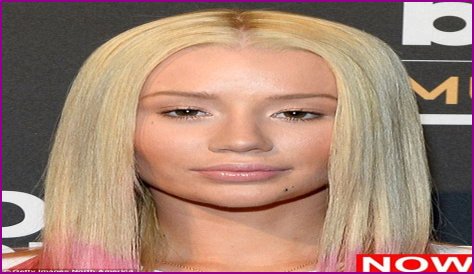 Iggy Azalea recently had a nose job & chin implant, says an Iggy source